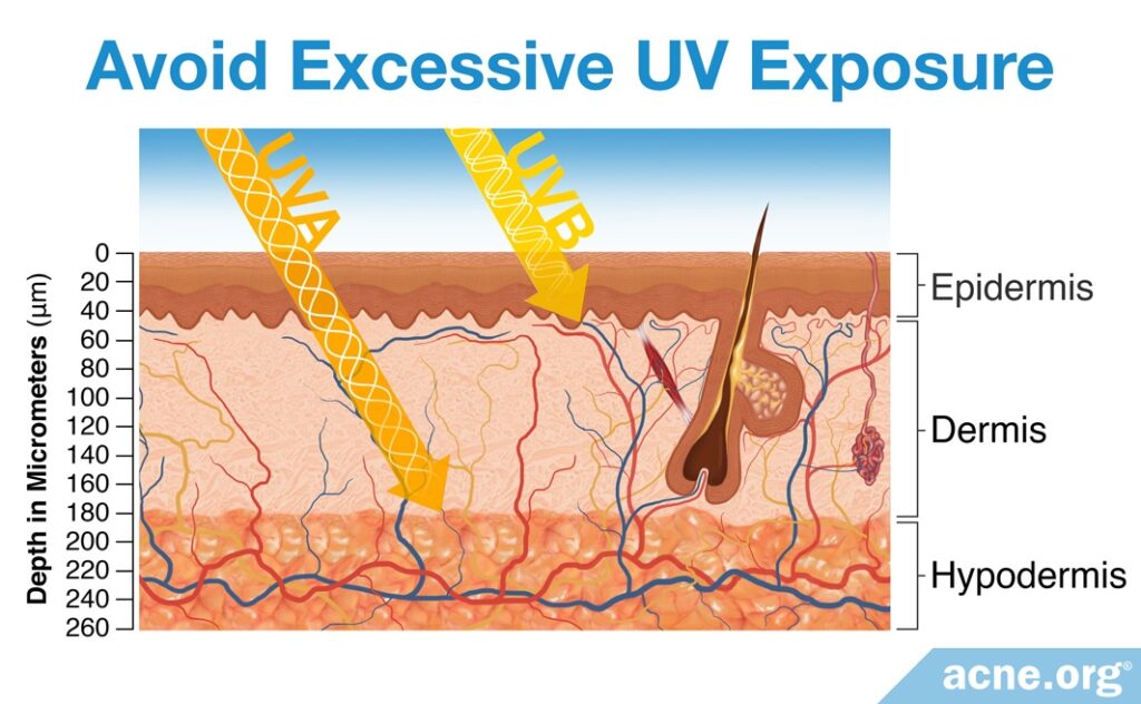 Avoid Excessive UV Exposure