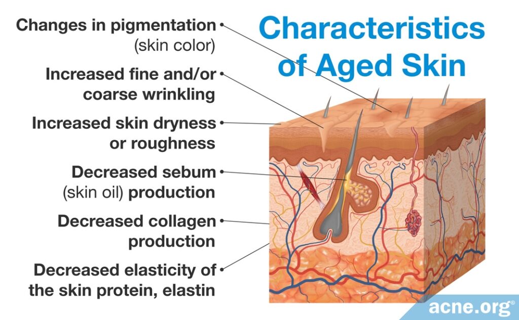 Characteristics of Aged Skin