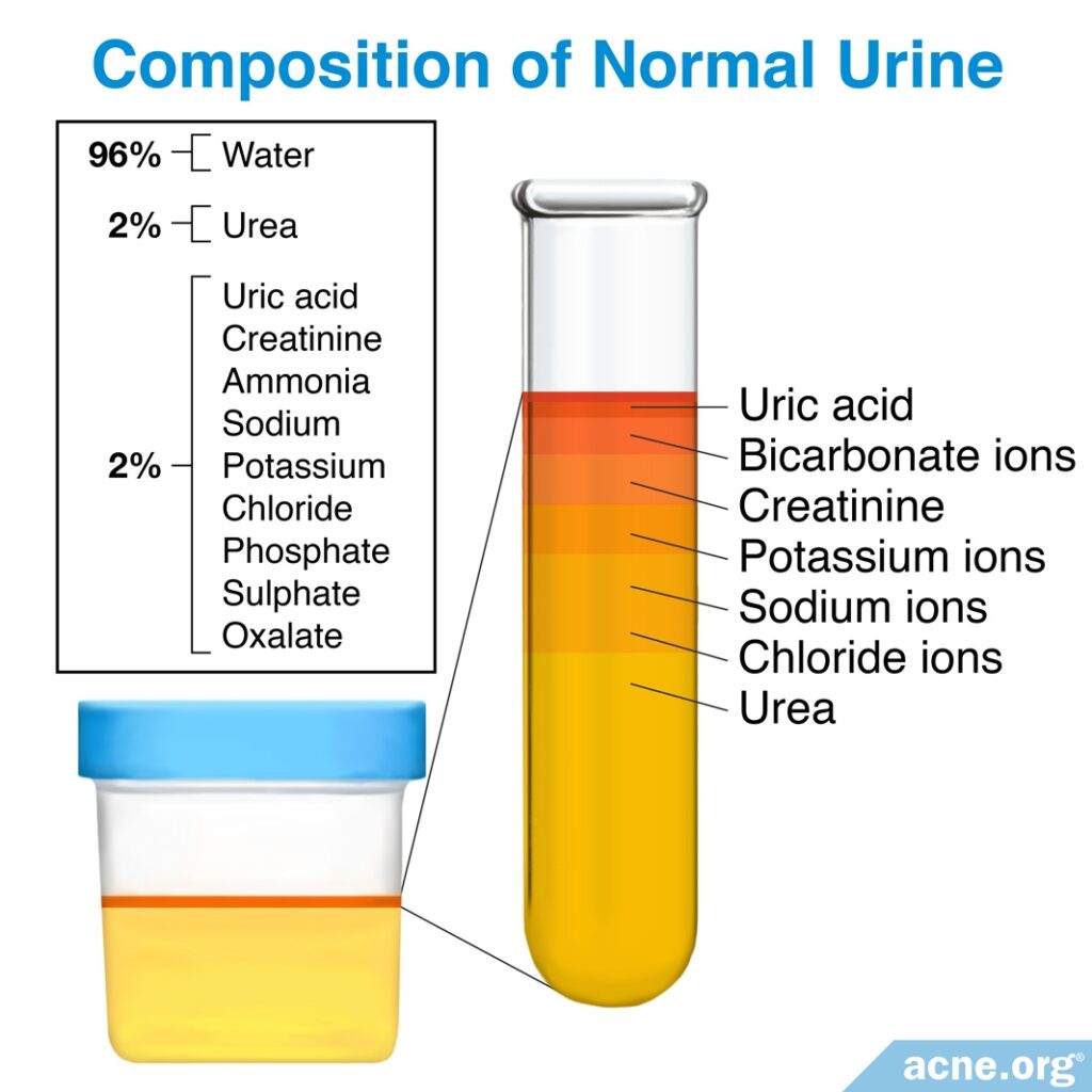Composition of Normal Urine