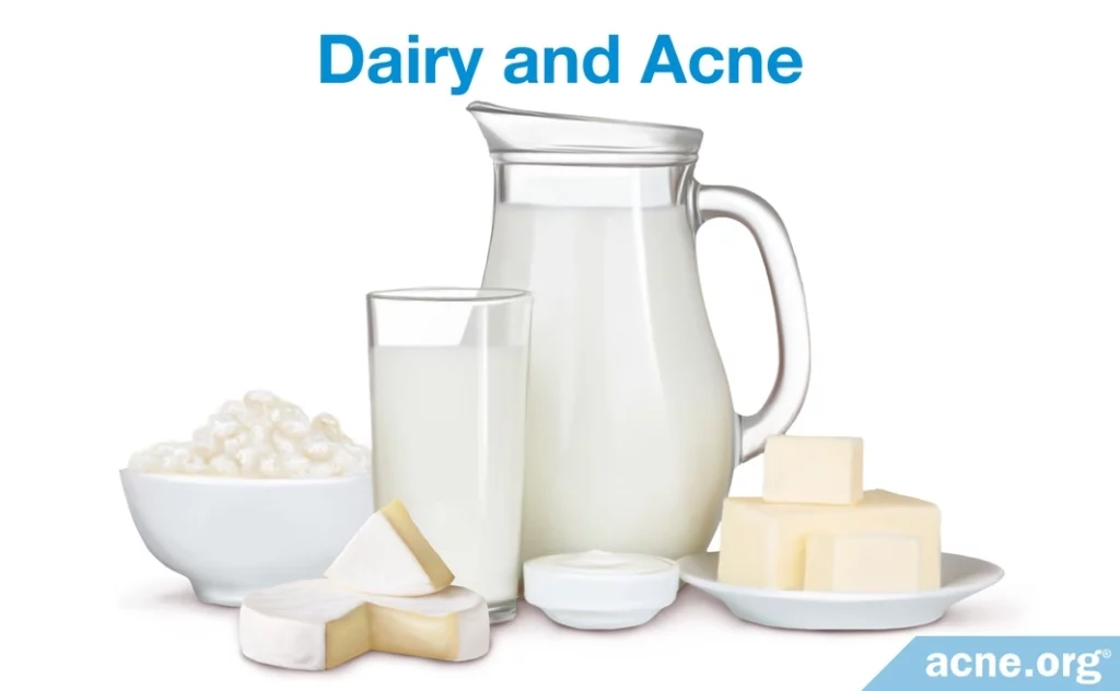 Dairy and Acne
