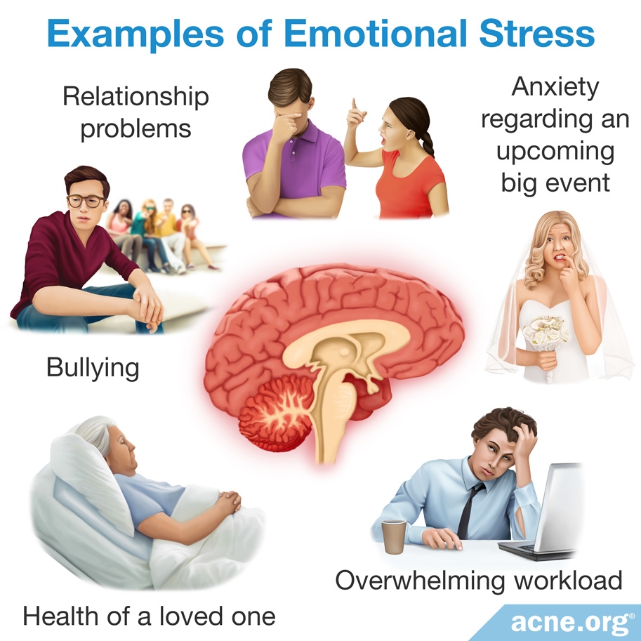 Examples of Emotional Stress