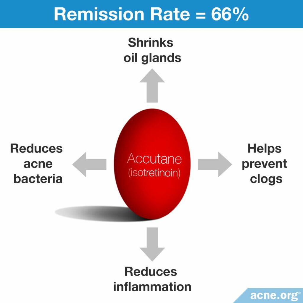 How Accutane (isotretinoin) Works