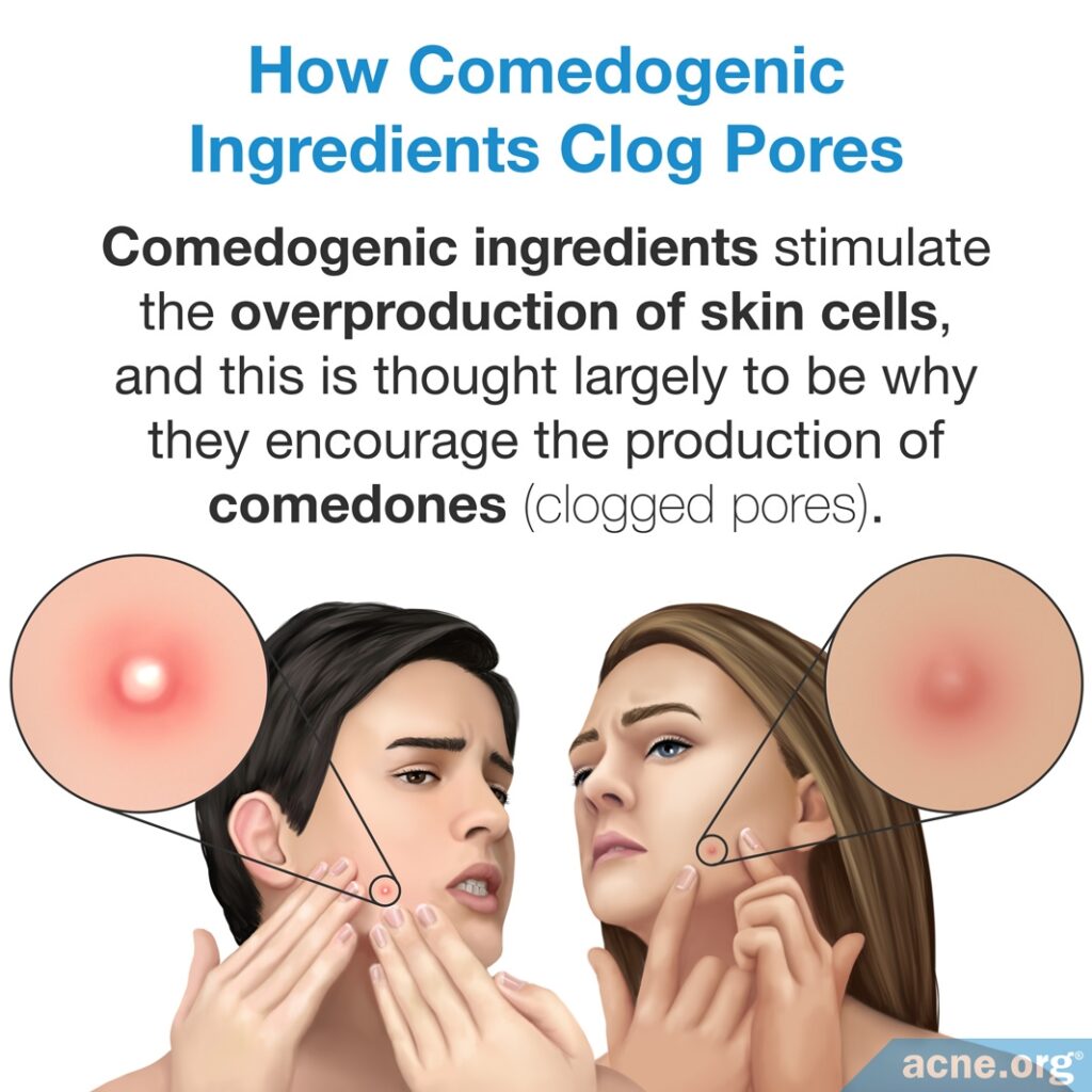 How Comedogenic Ingredients Clog Pores