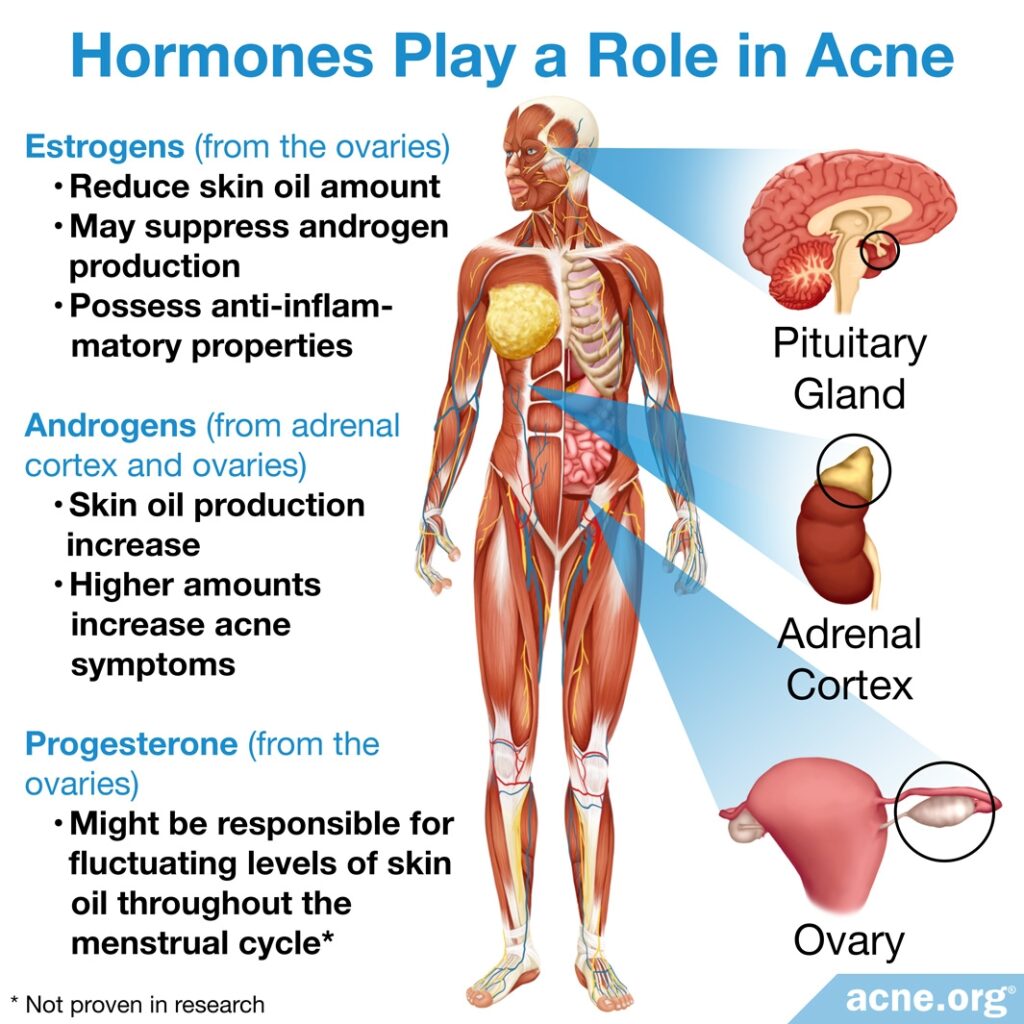 How Hormones Play a Role in Acne