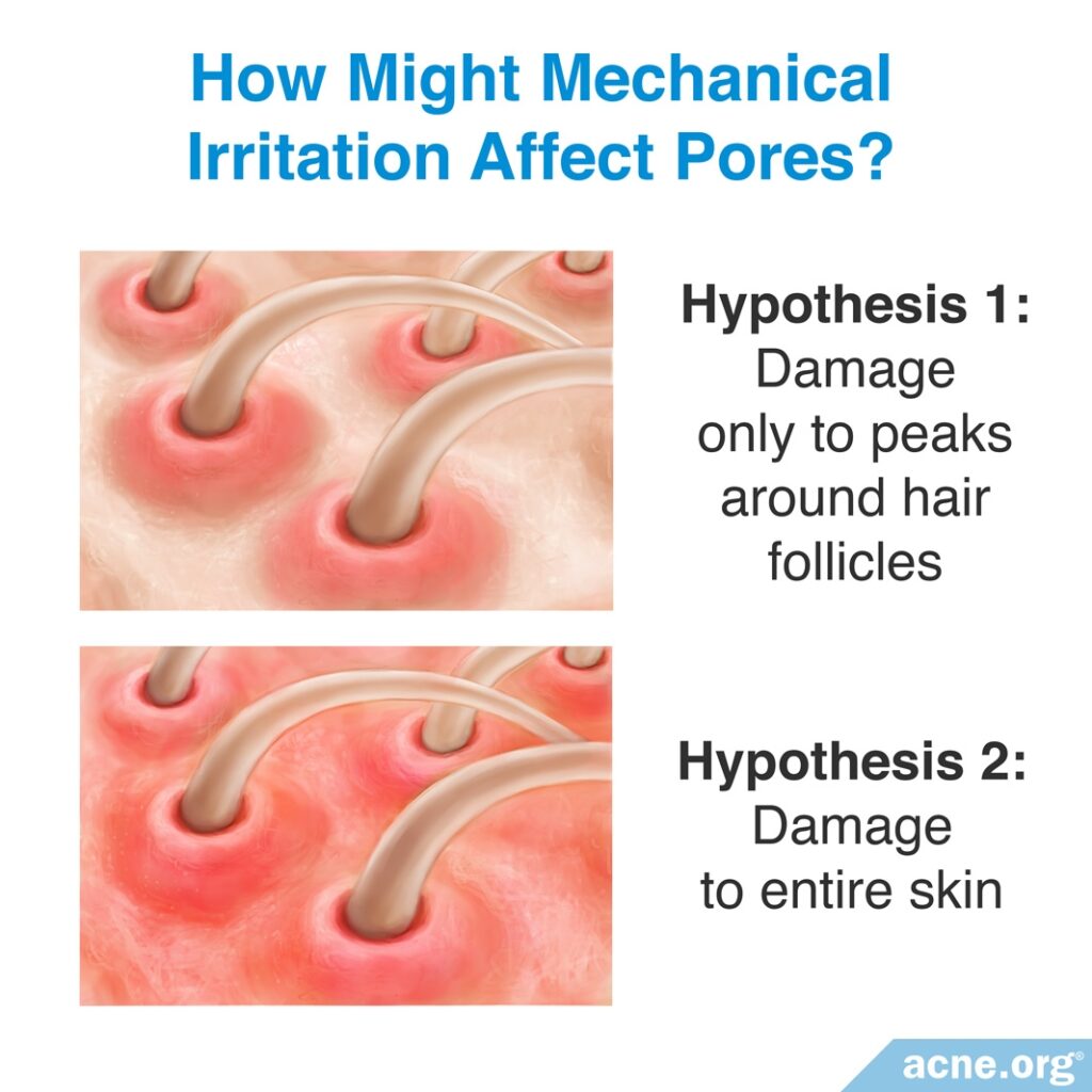 How Might Mechanical Irritation Affect Pores?