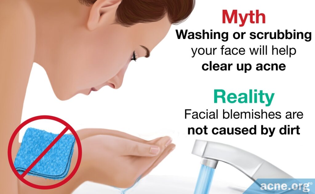 Myth: Washing or scrubbing your face will help clear up acne