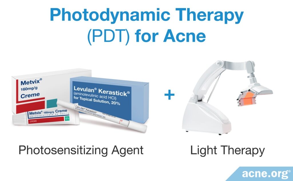 Photodynamic Therapy (PDT) for Acne