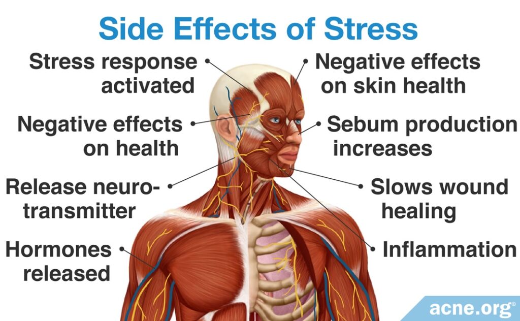 Side Effects of Stress