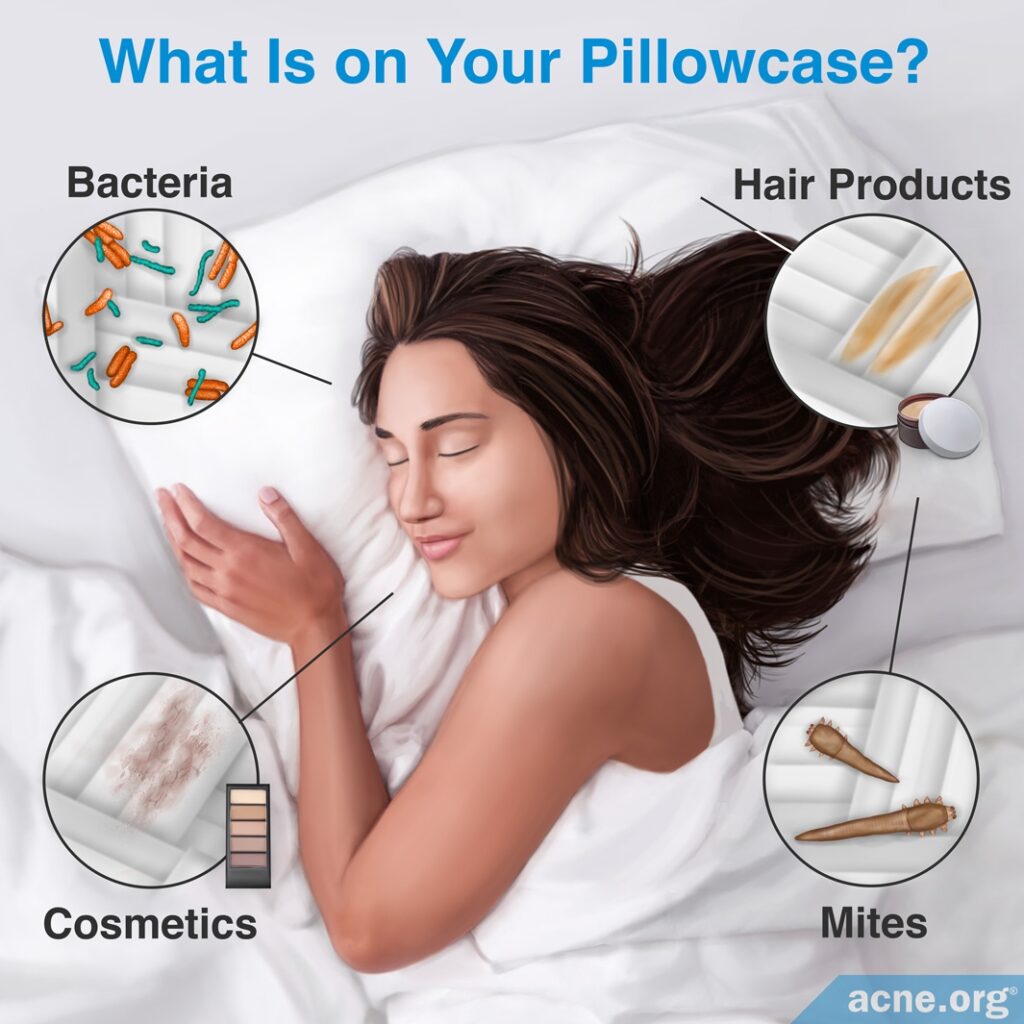 What Is on Your Pillowcase?