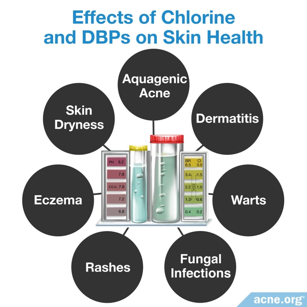 Effects of Chlorine and DBPs on Skin Health