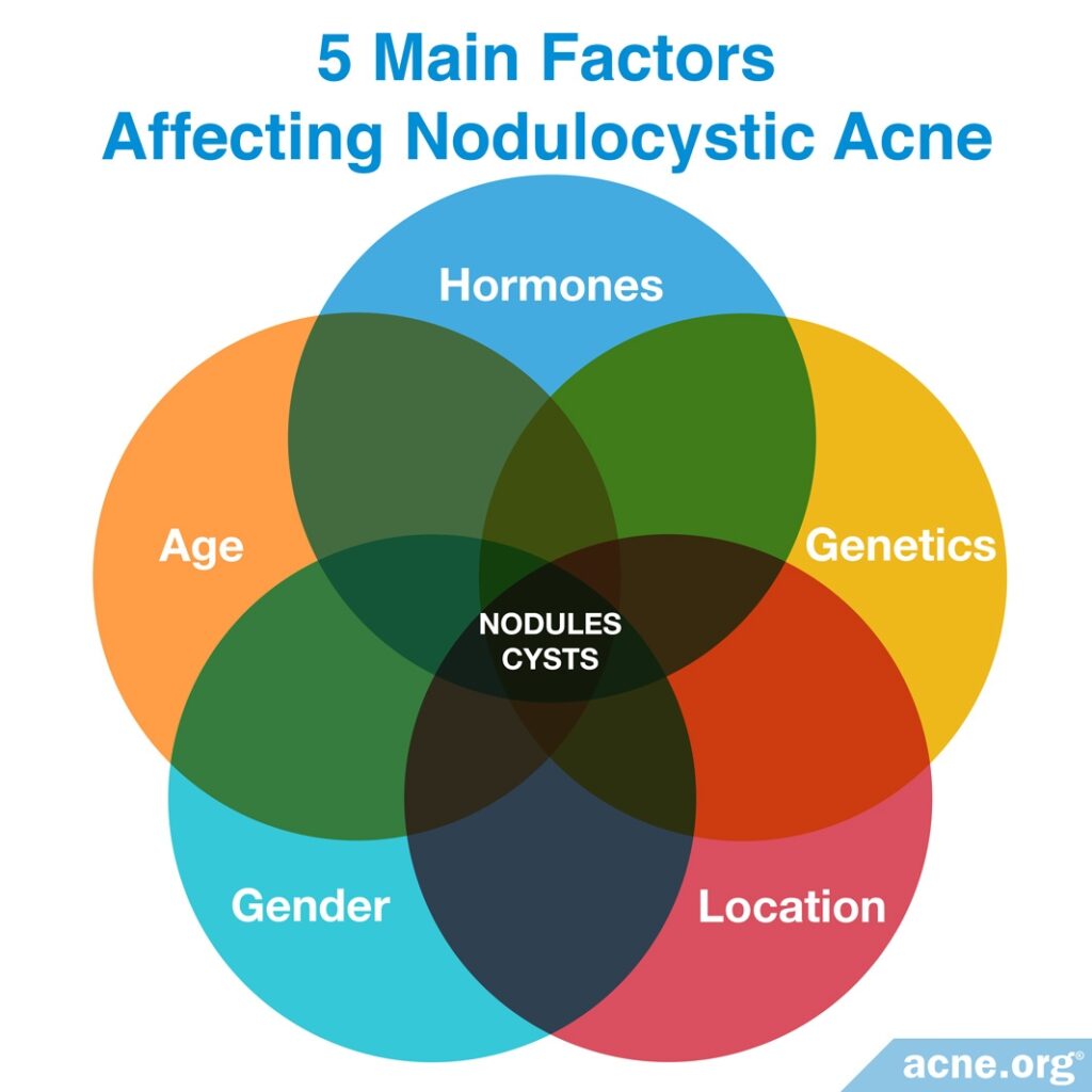 Five Main Factors Affecting Nodulocystic Acne