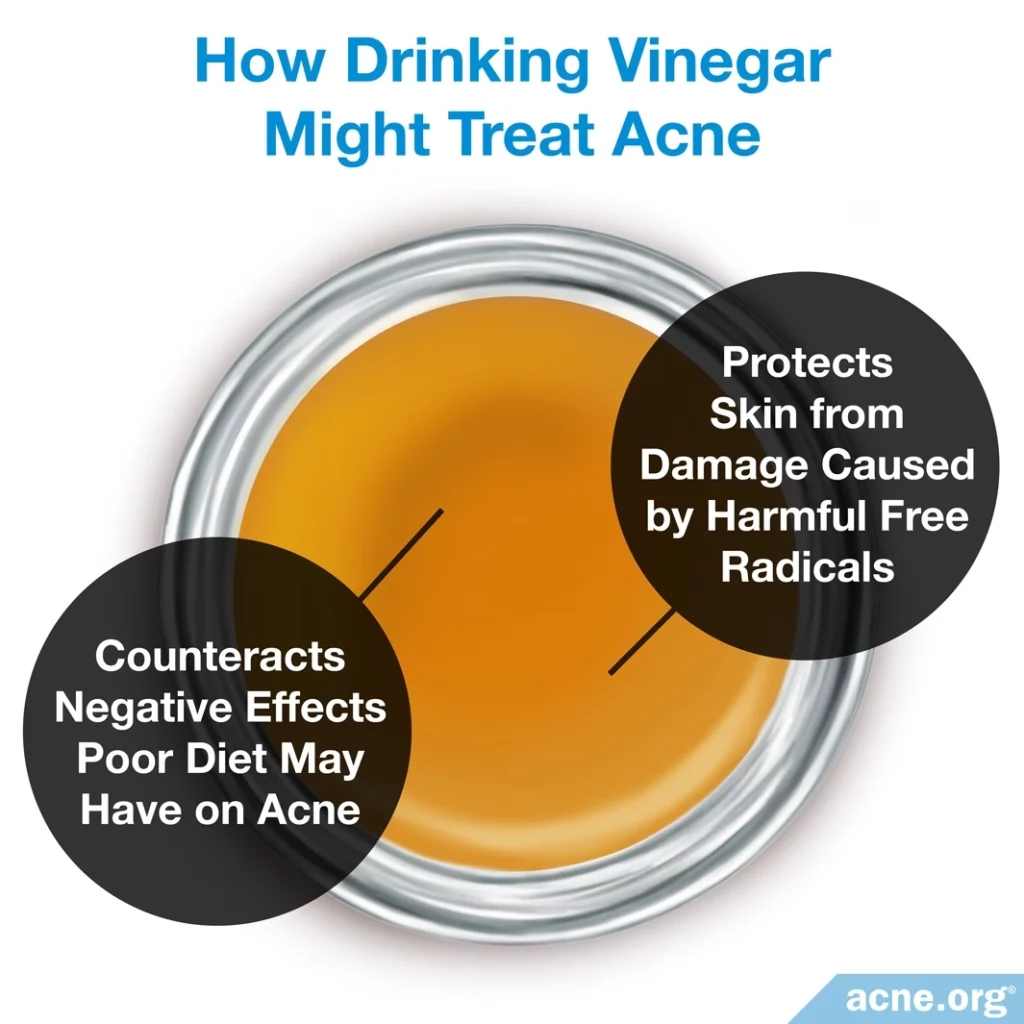 How Drinking Vinegar Might Treat Acne