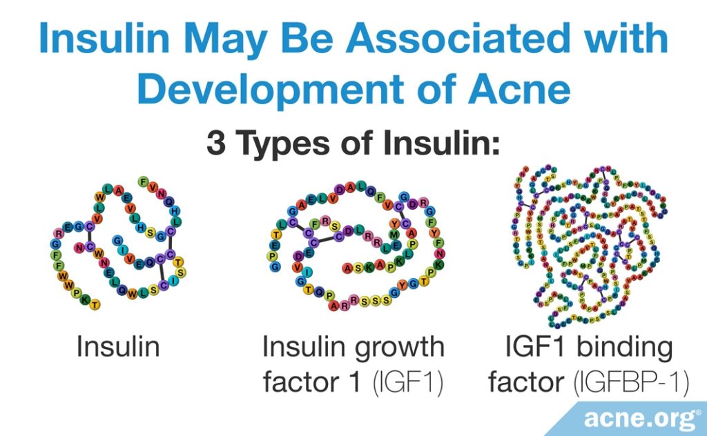 Insulin May Be Associated with Development of Acne