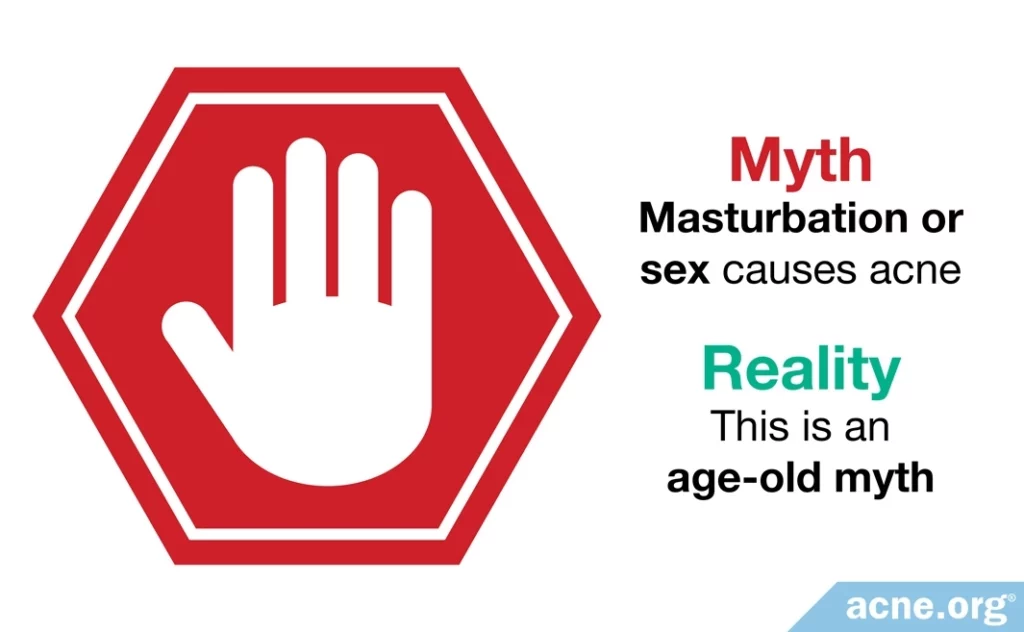 Myth: masturbation or sex causes acne