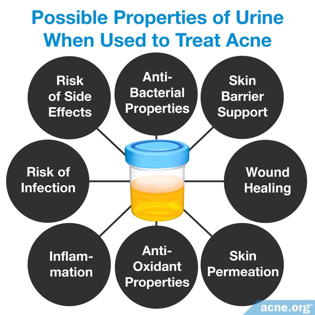 Possible Properties of Urine When Used to Treat Acne