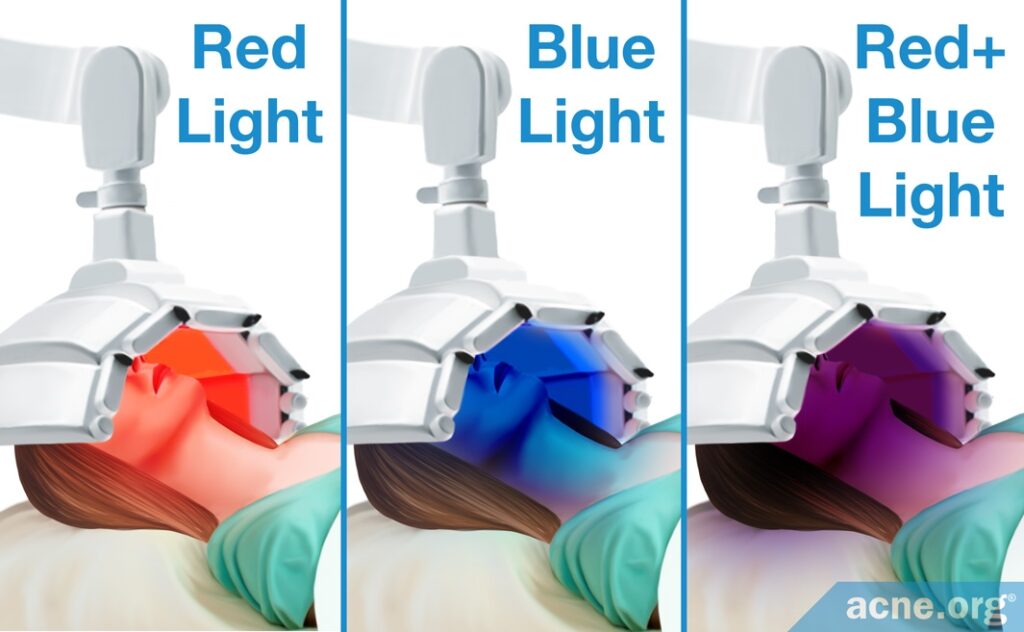 Red Light - Blue Light - Combination