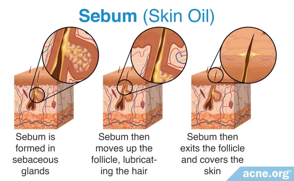 Sebum (Skin Oil)