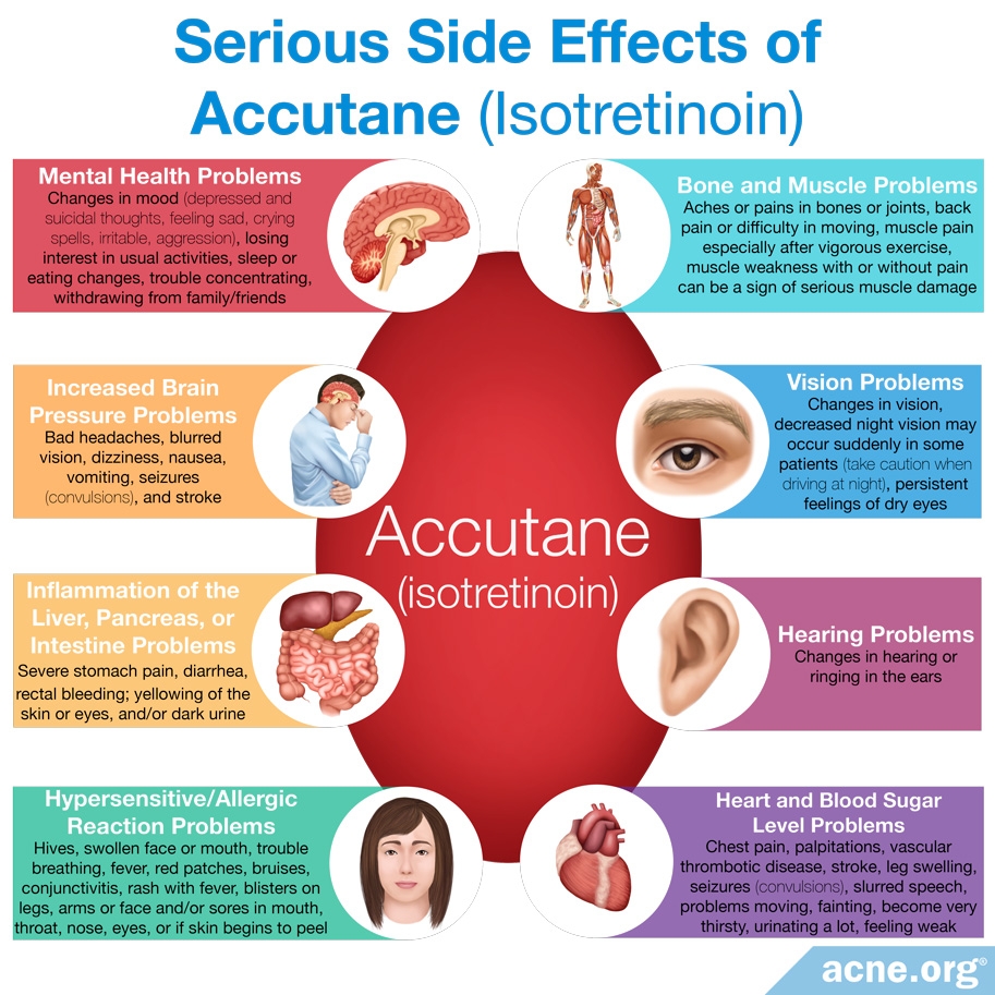 Serious Side Effects of Accutane (Isotretinoin)
