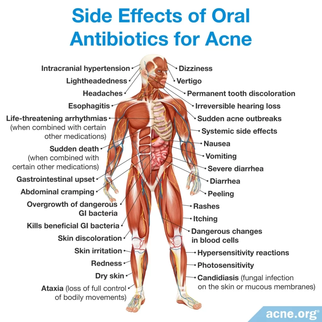 Efectos secundarios de los antibióticos orales