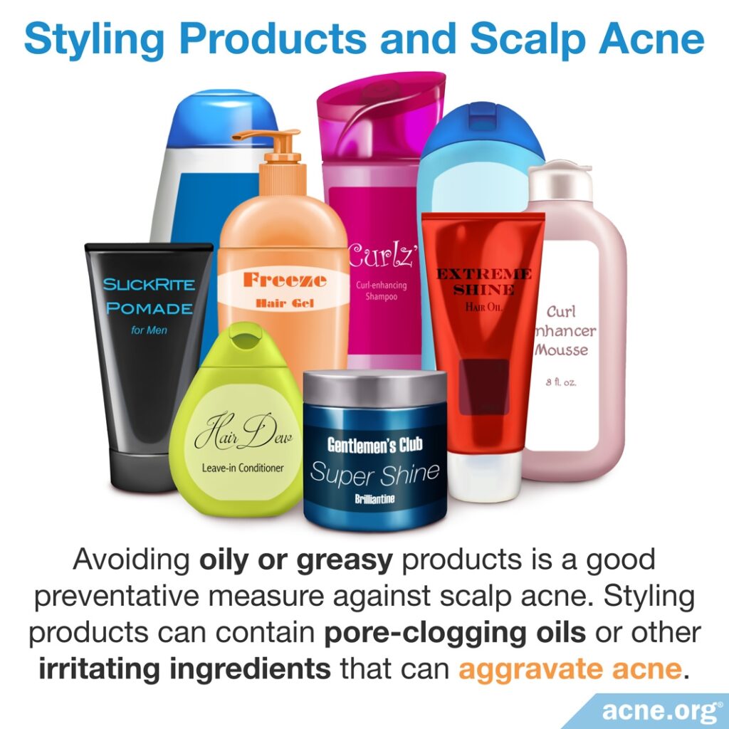 Styling Products and Scalp Acne