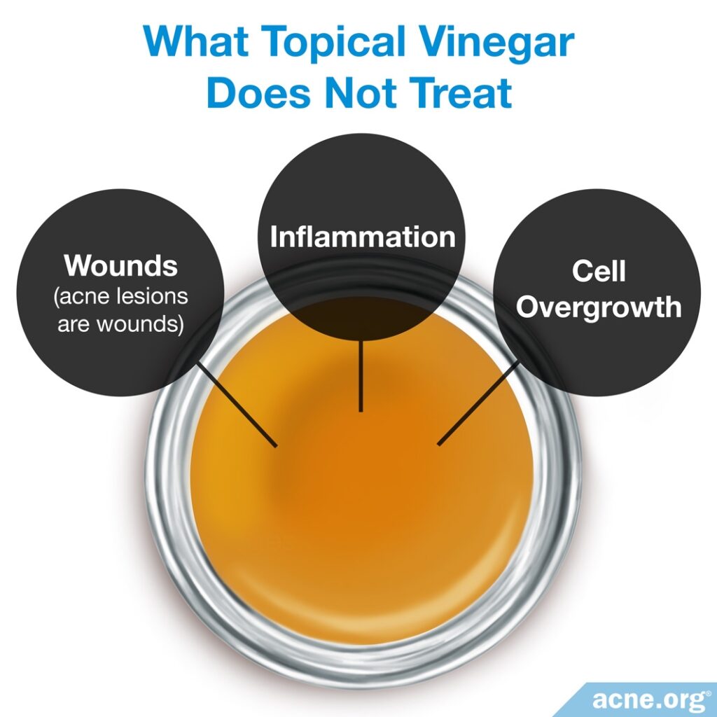 What Topical Vinegar Does Not Treat