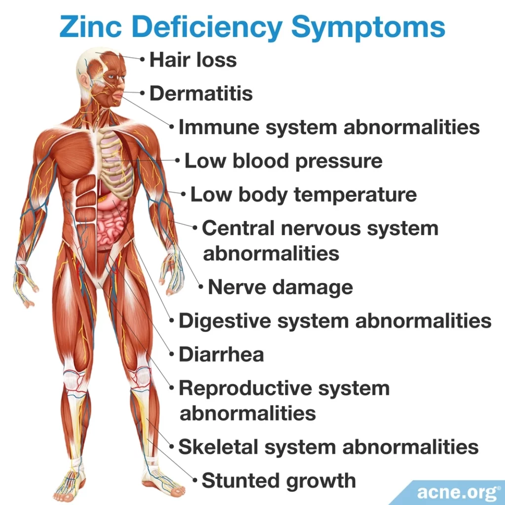 Zinc Deficiency Symptoms