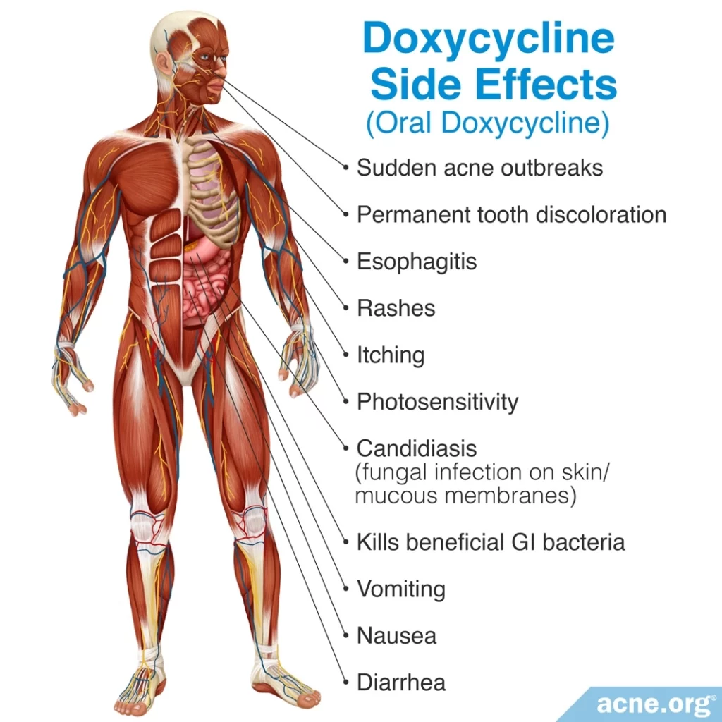 Doxycycline Side Effects