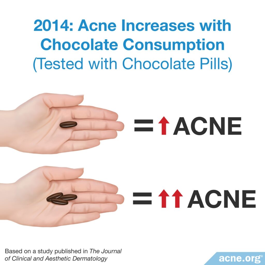 2014 Study: Acne Increases with Chocolate Consumption