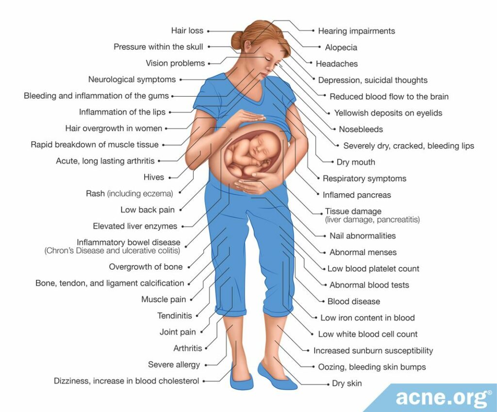 Accutane Side Effects on the Mother