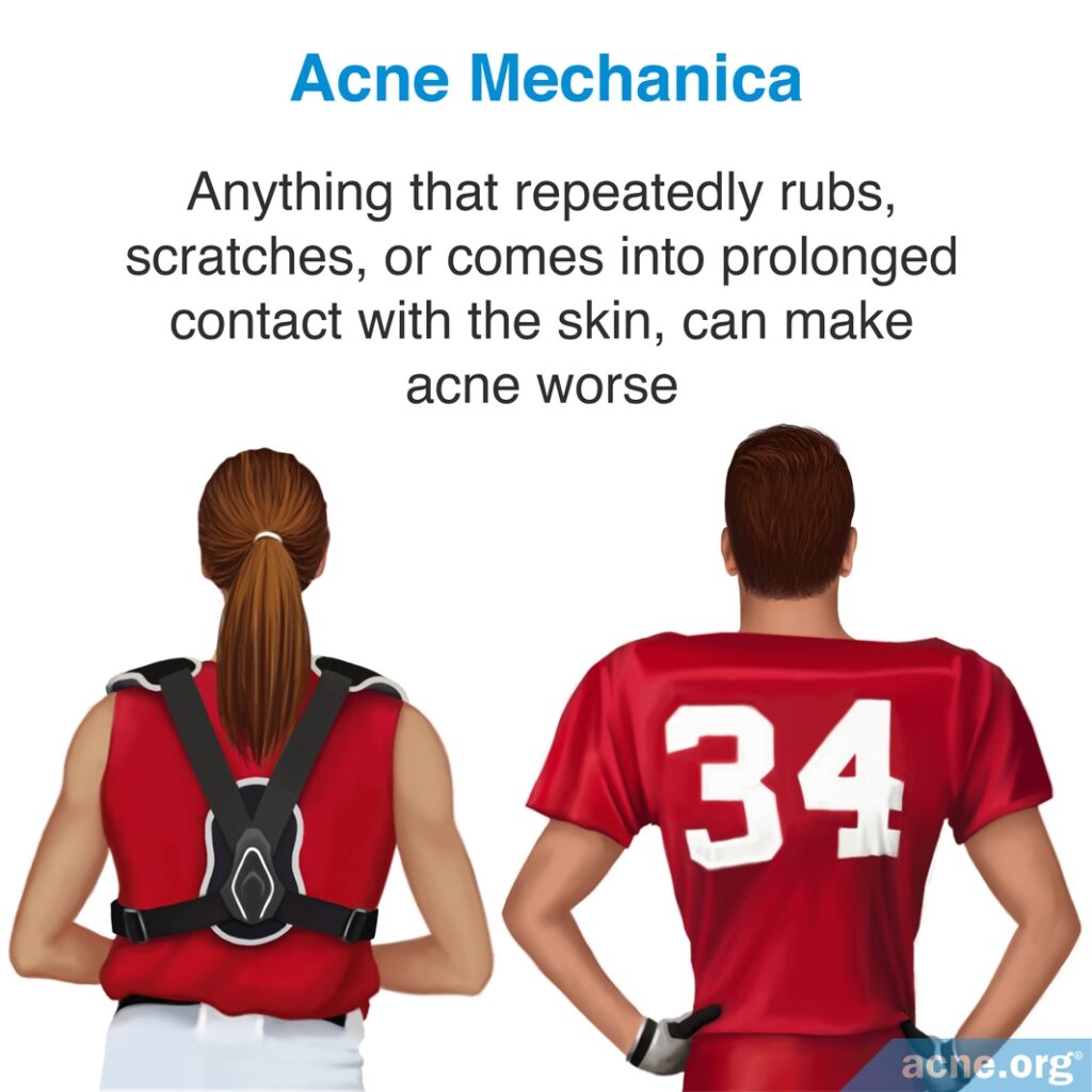 Acne Mechanica