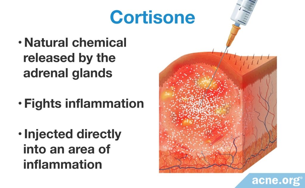 Cortisone