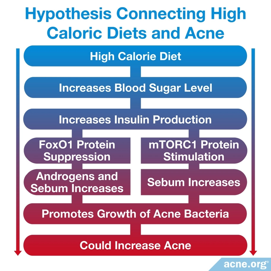 Hipótesis que conecta las dietas altas en calorías y el acné