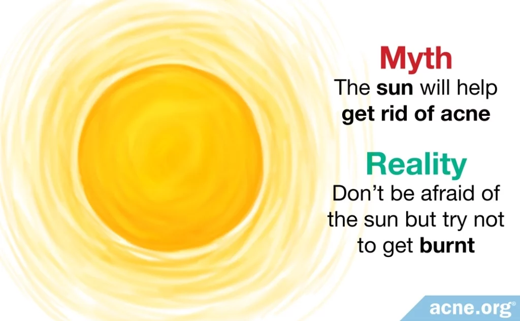 Myth: the sun will help get rid of acne