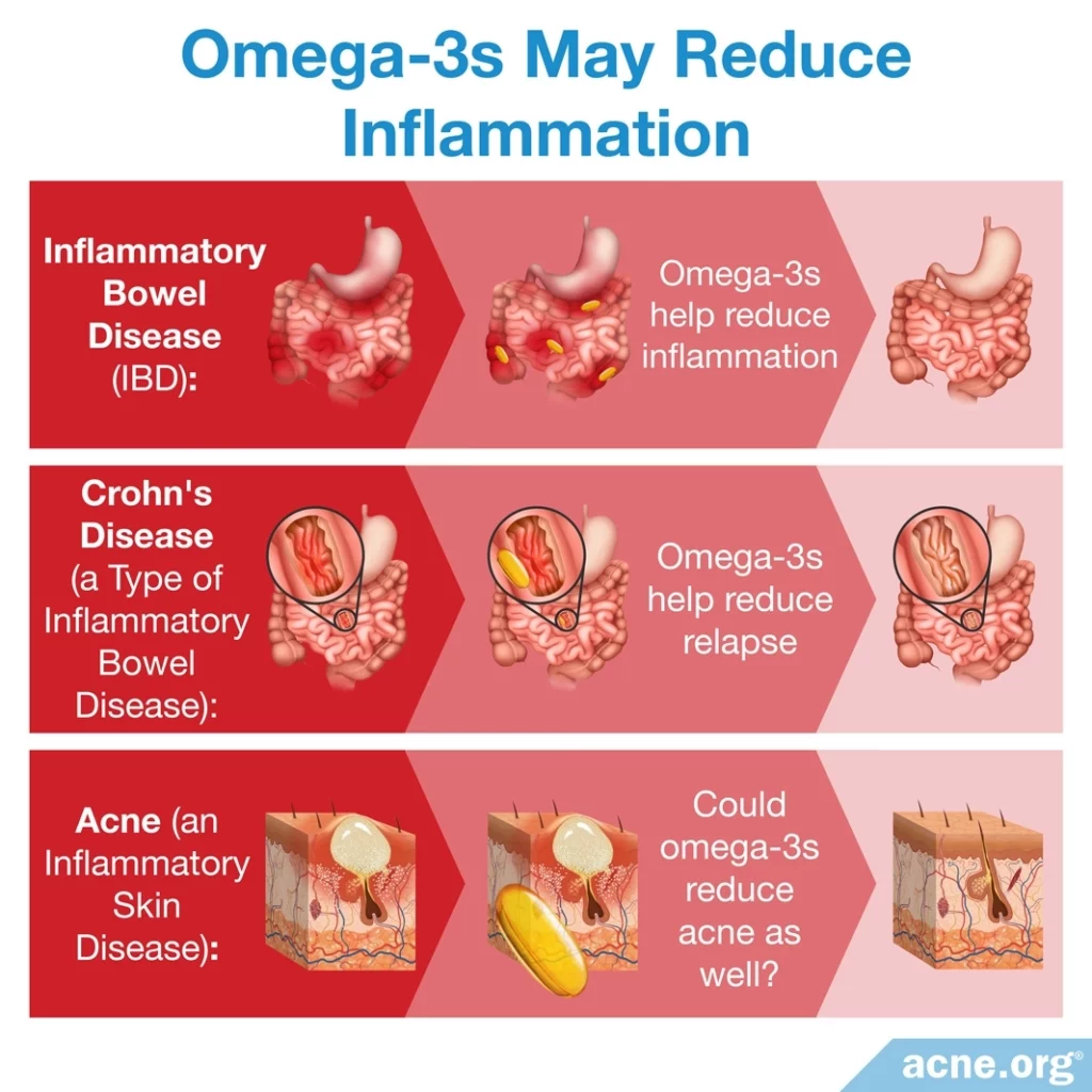 Los omega-3 pueden reducir la inflamación