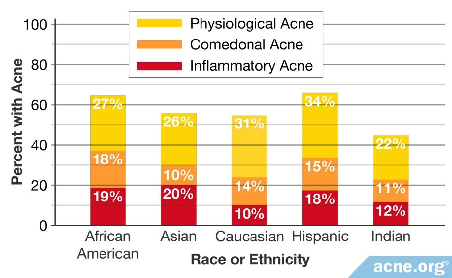 Percentage of Specific Types of Acne by Ethnicity