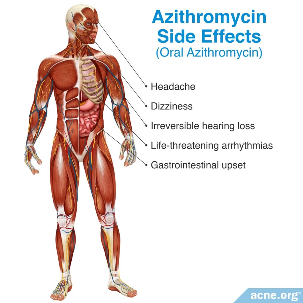 Azithromycin Side Effects