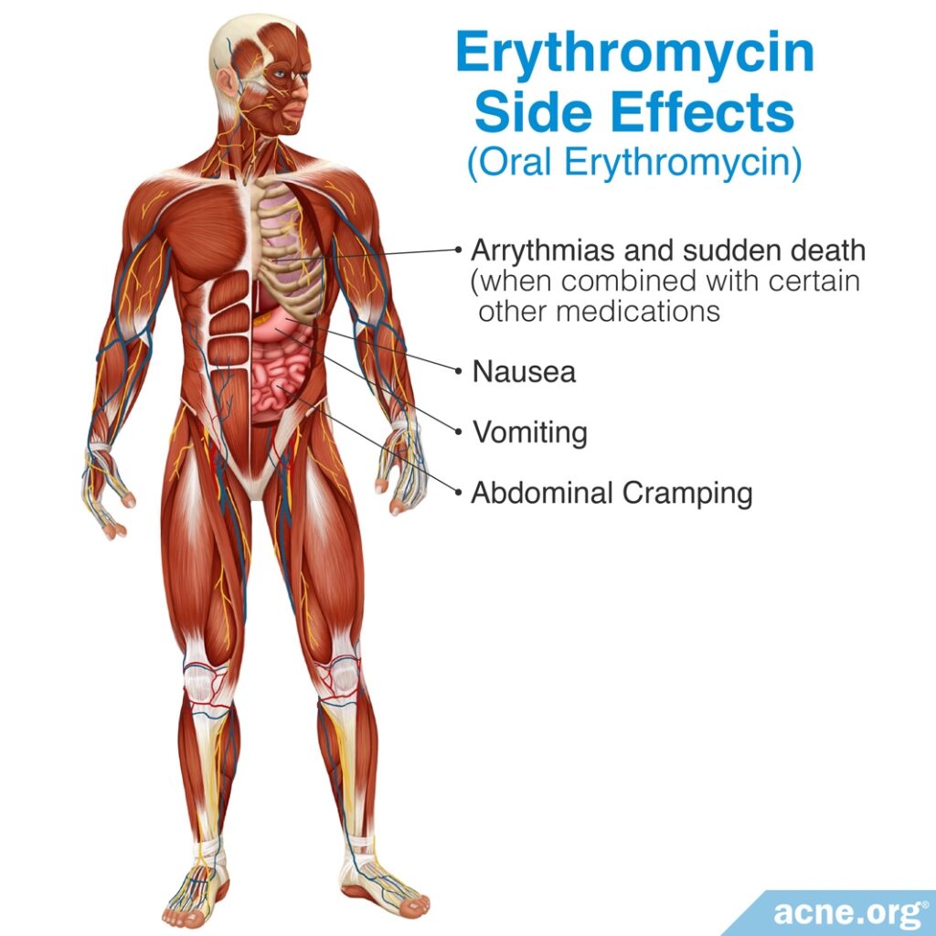 Oral Erythromycin Side Effects