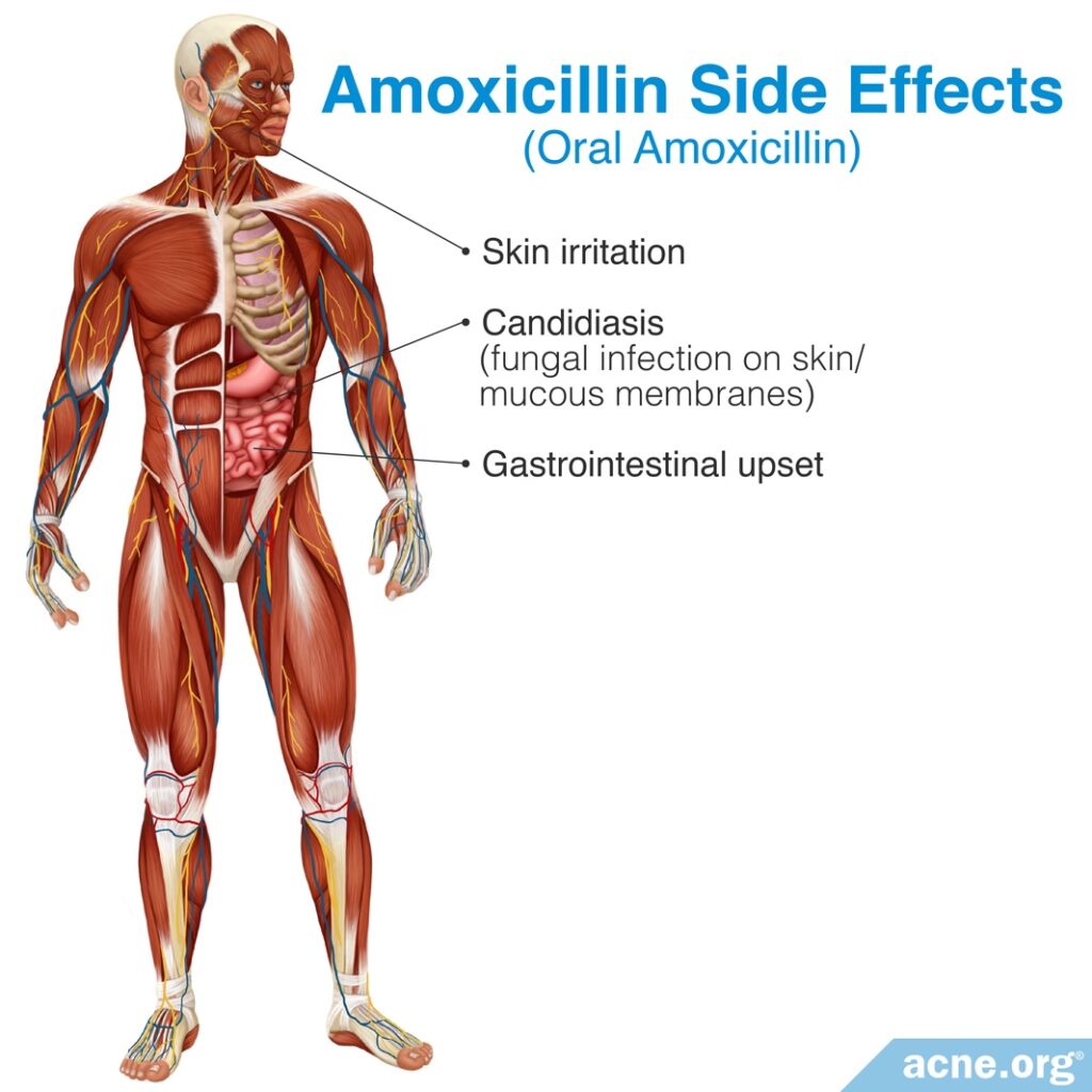 Amoxicillin Side Effects