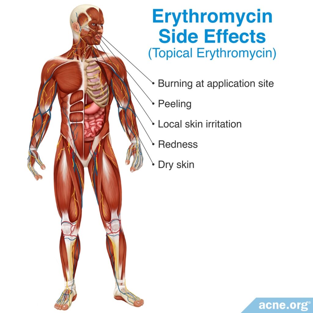 Erythromycin Side Effects