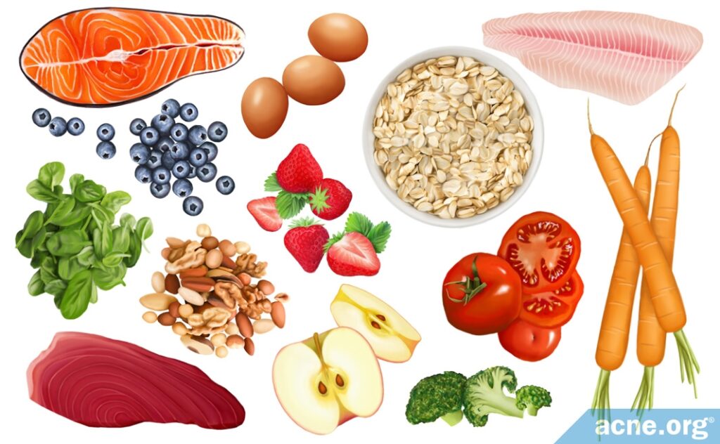 Alternative Therapies for Acne: Diet