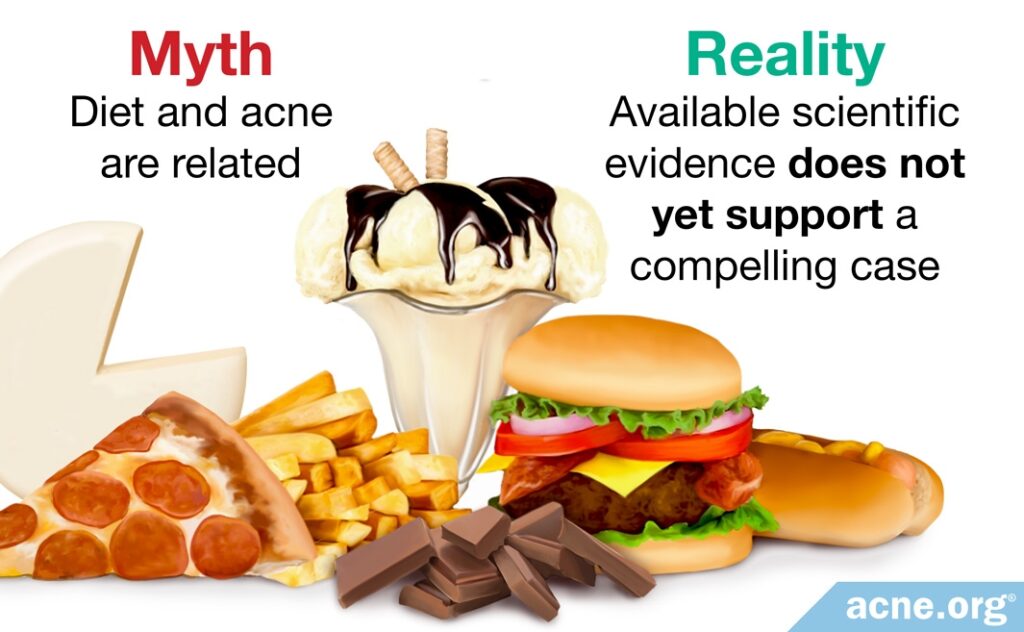 Myth: diet and acne are related