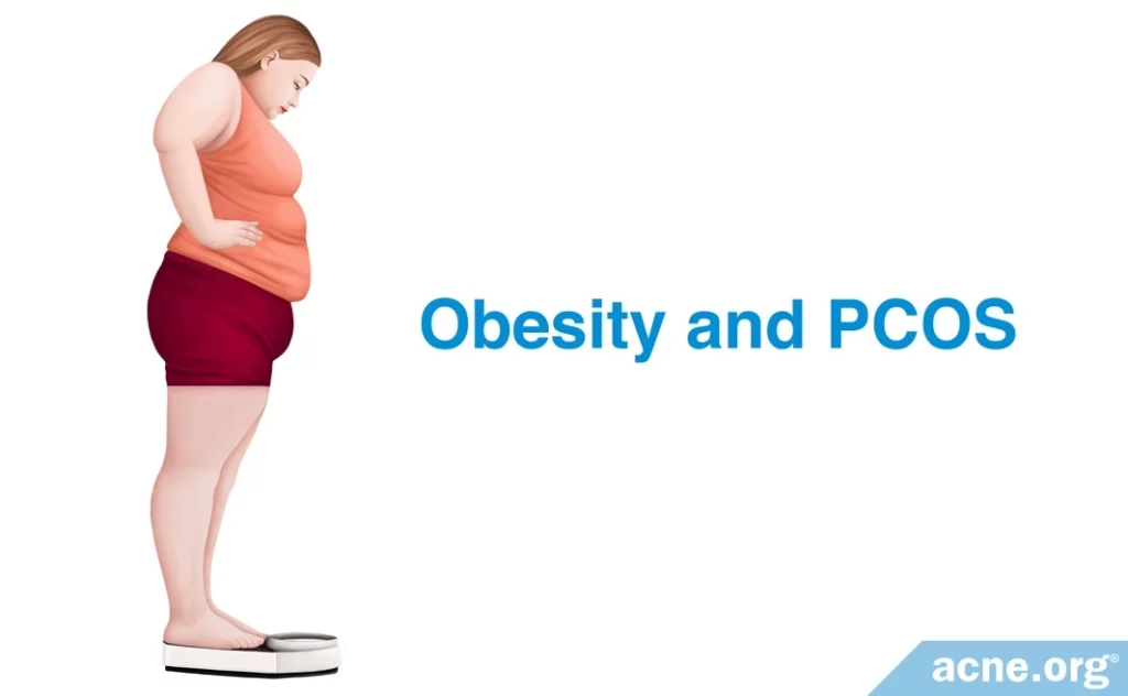 Obesity and PCOS