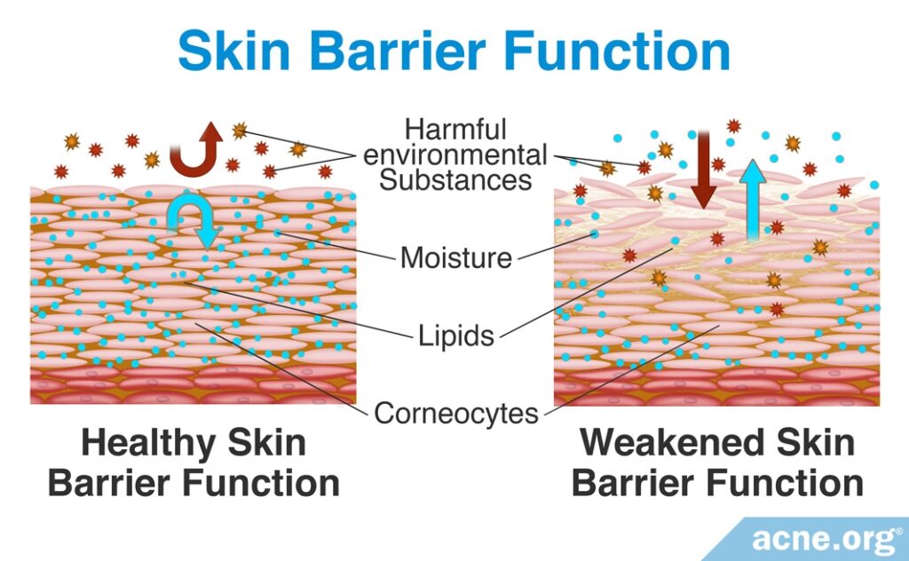 Skin Barrier Function: Weakened Barrier Function vs. Healthy
