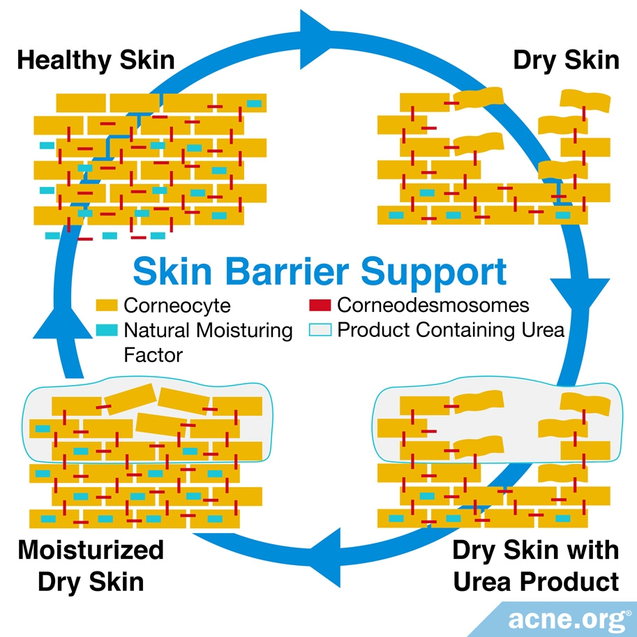 Skin Barrier Support
