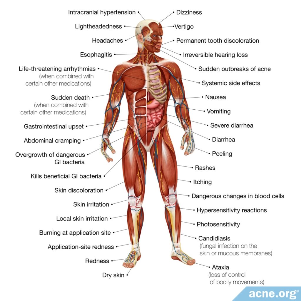 The Side Effects of Antibiotics