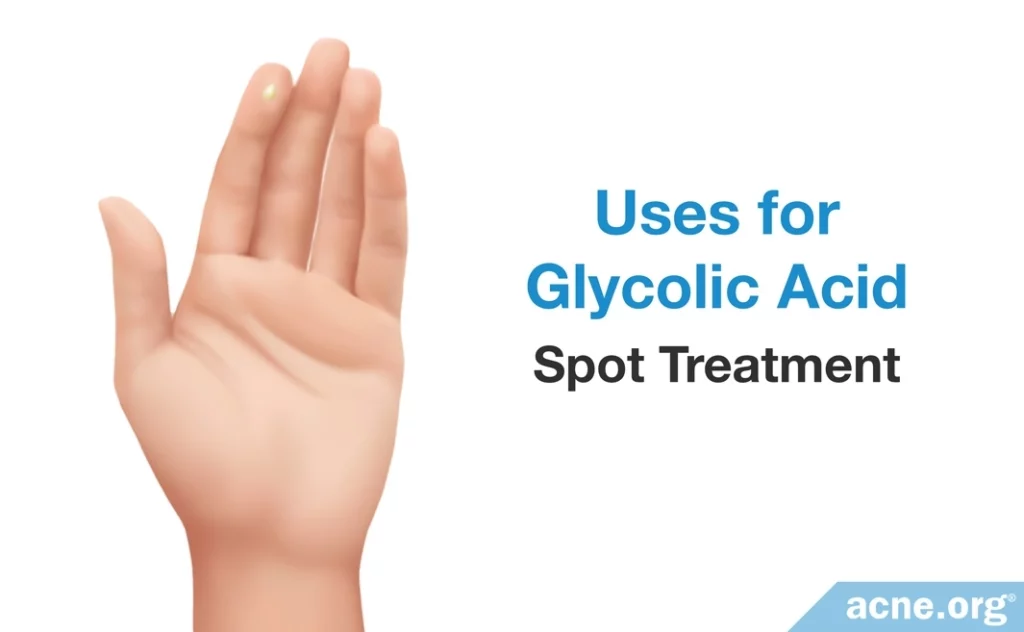 Uses for Glycolic Acid: Spot Treatment