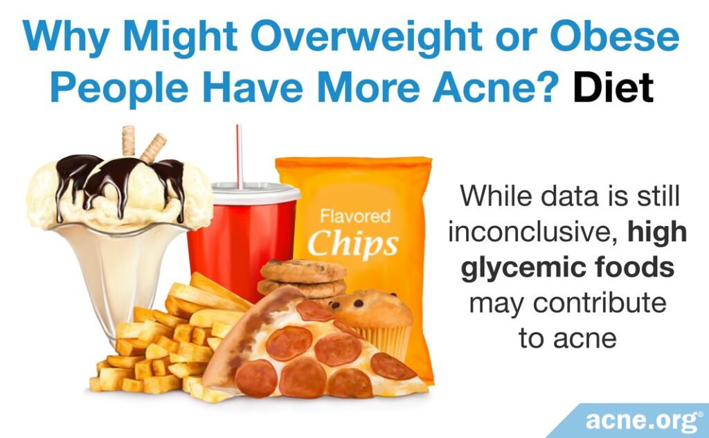 Why Overweight or Obese People Might Have More Acne: DietMobile image here