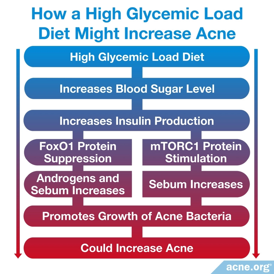 Cómo una dieta de carga glucémica podría aumentar el acné