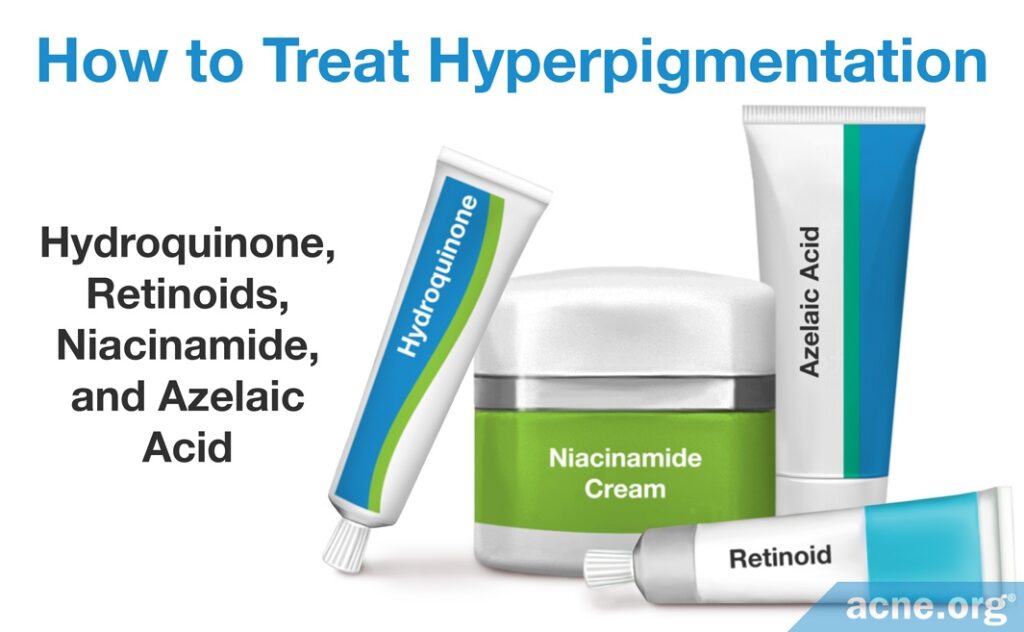 How to Treat Hyperpigmentation