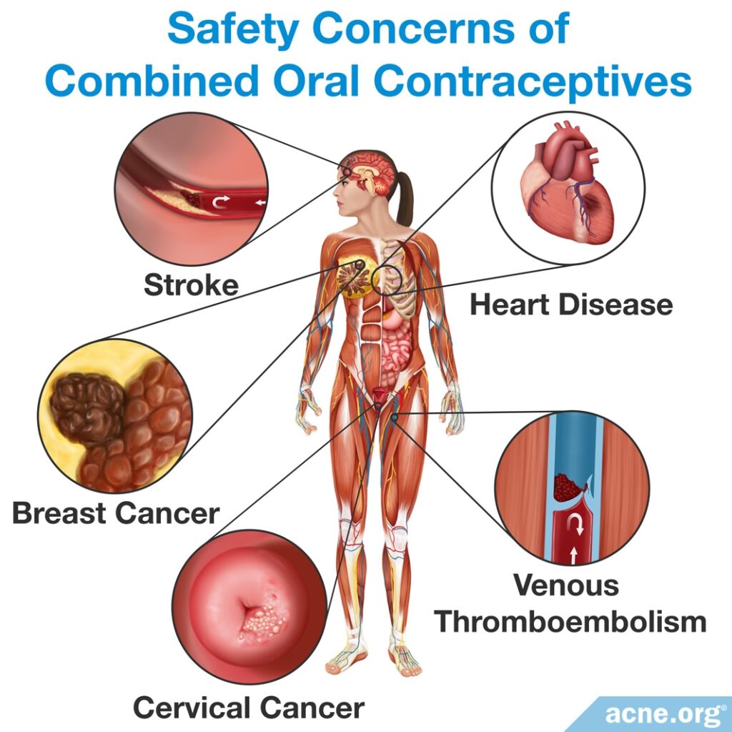 Safety Concerns of Combined Oral Contraceptives